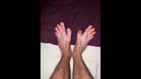 Unique Deformity: Man with Hands for Feet 🦶👐👀😮