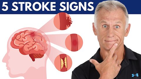 5 Stroke Signs, What To Do-FAST & Prevention