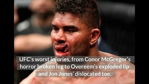 GRAPHIC - UFC’s Worst Injuries