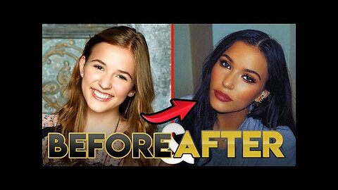 Lennon Stella Glow Up 2019 - Before and After Transformations ( Lips, Hair, Diet & More )