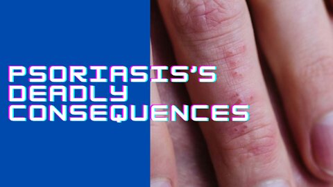 Psoriasis’s Deadly Consequences