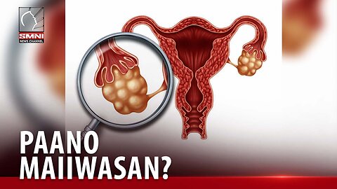 ALAMIN | Paano maiiwasan ang Polycystic ovary syndrome (PCOS)?