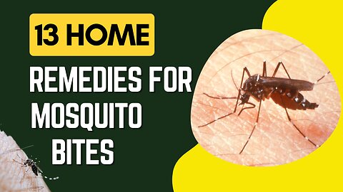 13 Home Remedies For Mosquito Bites: Number 7 is Unreal