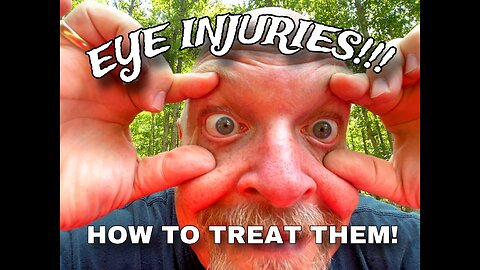 EYE INJURIES, HOW TO TREAT THEM!