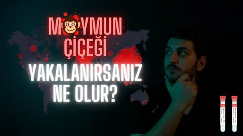 Maymun Çiçeği Hastalığına Yakalanırsanız Ne Olur?