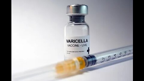 Varicella aka Chickenpox and Shingles
