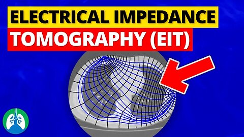 Electrical Impedance Tomography (EIT) | Quick Explainer Video