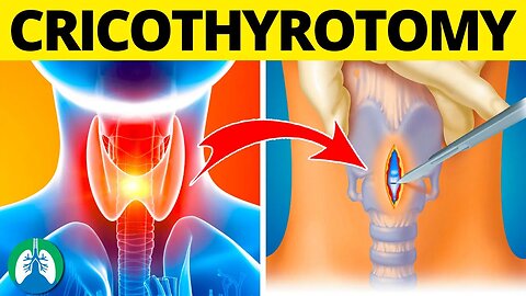 Cricothyrotomy (Medical Definition) | Quick Explainer Video