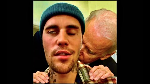 Justin Bieber Face Exposes Deadly Covid mRNA Vaccine Side Effects Did USA Finance Depopulation Plan