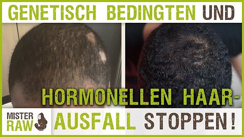 Genetisch- und hormonellbedingten Haarausfall rückgängig gemacht - Der lebendige Beweis!