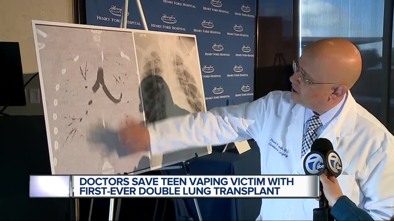 Vaping-related lung transplant performed at Detroit hospital