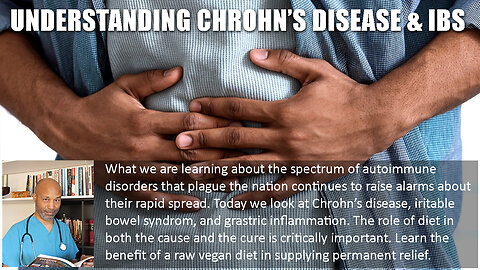 Understanding Crohn's Disease and IBS
