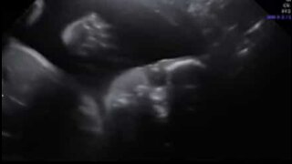 Bebê olha para câmera e acena durante ultrassom