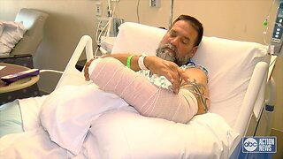 Full interview: Flesh-eating bacteria infects Florida fisherman in Gulf of Mexico