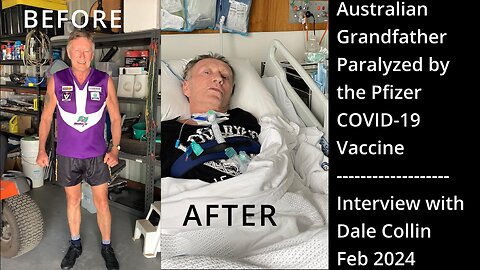 Australian Grandfather Paralysed by Pfizer COVID-19 Vaccine | Interview with Dale