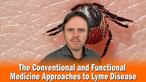 The Conventional and Functional Medicine Approaches to Lyme Disease