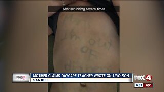Mom outraged after teacher wrote on 1-year-old's stomach