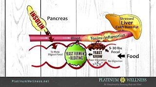 Platinum Wellness: You can drop the weight and get healthy this year!