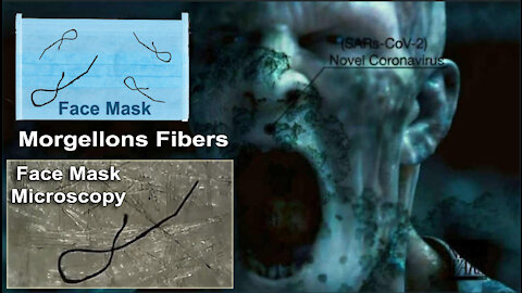 MORGELLONS Discovered in Disposable Face Masks