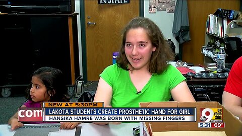 Lakota students create prosthetic hand for 5-year-old girl