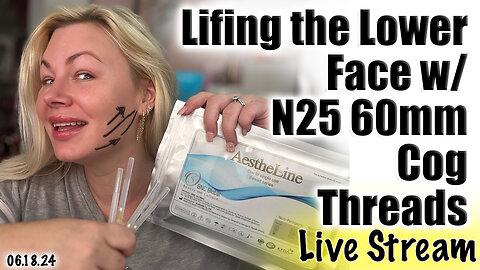 Live Lifting my Lower Face with N25 Cog Threads, AceCosm | Code Jessica10 Saves you money