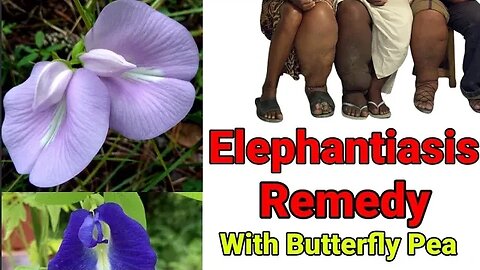 Elephantiasis With Butterfly Pea | Heal Yourself GH | Heal Yourself Herbal. #subscribe #like #share