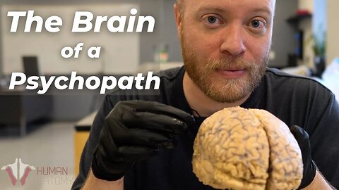 Inside the Brain of a Psychopath