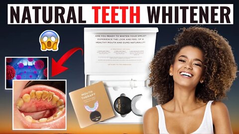 NATURAL TEETH WHITENER - Is LED Teeth Whitening Worth Buying? (My Honest Teeth Whitener Review)