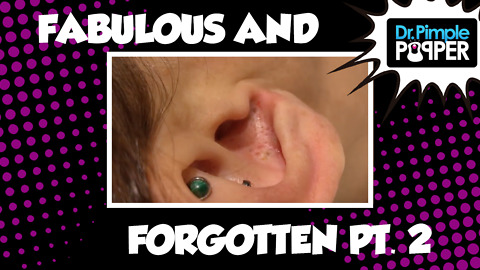 Blackheads: The Fabulous & Forgotten, Part Two (Ft. Pimple Pete!)