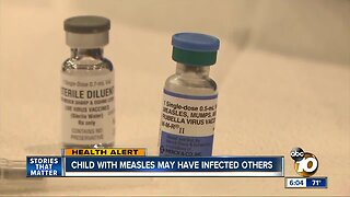 San Diego child with measles may have infected others