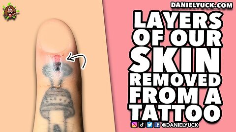 This Guy Just Had A Layer Of Skin Removed From His Tattooed Finger!