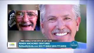 Renew Anchored Dentures // Renew Your Smile