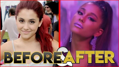 Ariana Grande | Before & After | Transformation ( Hair, Plastic Surgery, Make Up & More )