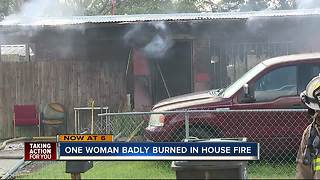 Woman burned in house fire