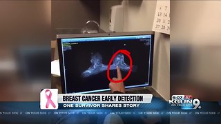 Breast cancer survivor talks about early detection