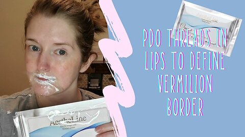PDO Threads in Lips to Define Vermilion Border | My 1st Thread Video from 2021 🤗