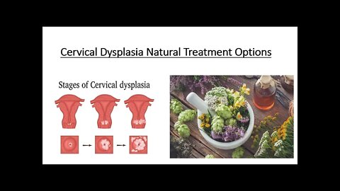 Cervical Dysplasia Natural Treatment Options