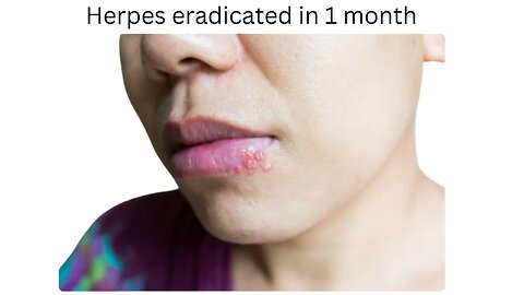 Herpes gone in 1month 2019 testimonial...