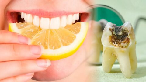 7 Alimentos que Fazem Mal para os Dentes. Veja!