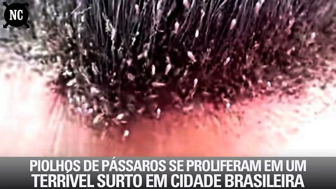 Piolhos de pássaros se proliferam em um terrível surto em cidade brasileira