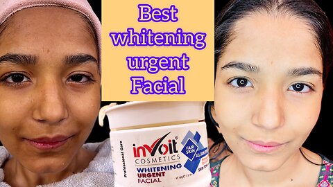 Invoit Whitening Urgent Facial Treatment | Parlour Jesa Whitening facial For Dark And Dull Skin | 😍
