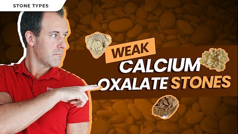 Weak Calcium Oxalate SUBTYPE: Dihydrate