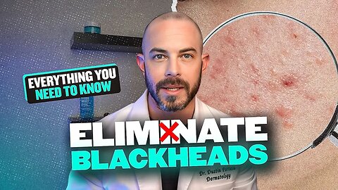 Blackheads & Whiteheads - How to Get Clear Skin According to a Derm