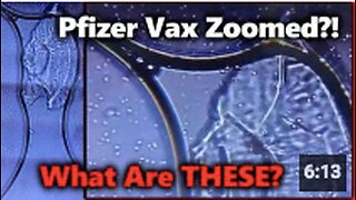 DISTURBING! Pfizer Vaccine Zoomed w/ Microscope?! Are Living Cells/ Organisms Mixed In?!