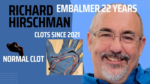 EMBALMERS FIND STRANGE CLOTS SINCE 2021 RICHARD HIRSCHMAN