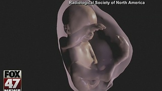 Virtual reality used in new ultrasounds