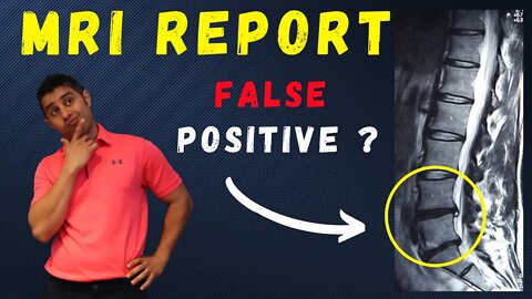 Lumbar Spine MRI Report False Positive