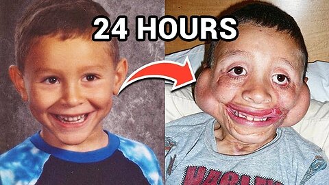 10 Kids who survived the impossible