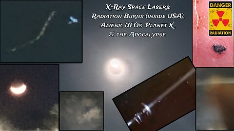 X-Ray Space Lasers, Radiation Burns (USA), & UFOs / UAPs! Planet X, Aliens, & the Apocalypse!