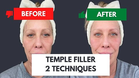 Temple Restoration using Two Techniques
